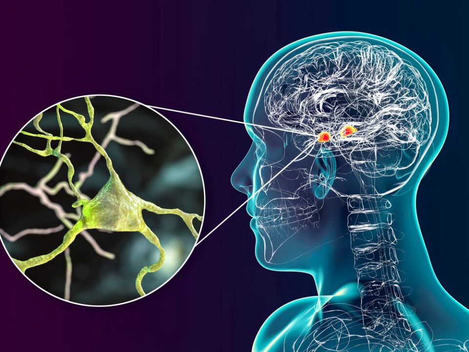 Πώς η Βαρηκοΐα συσχετίζεται με την Άνοια;